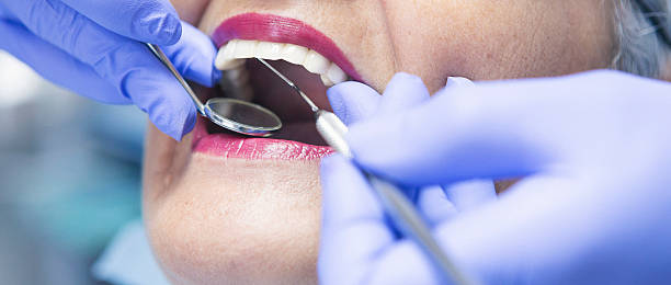 Best Knocked-Out Tooth (Avulsed Tooth) Treatment in Laguna Niguel, CA